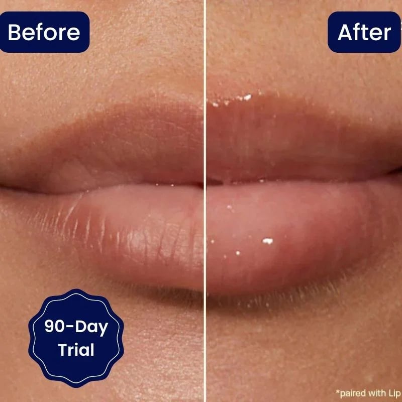 🔥Rabatt zum halben Preis🔥🔥Lippenserum mit Vitamin E