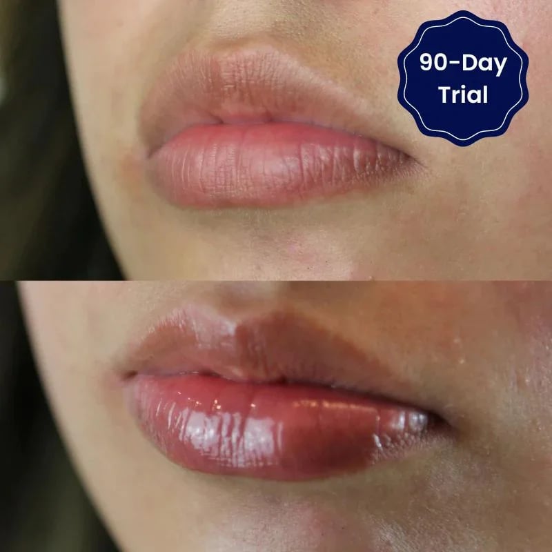🔥Rabatt zum halben Preis🔥🔥Lippenserum mit Vitamin E