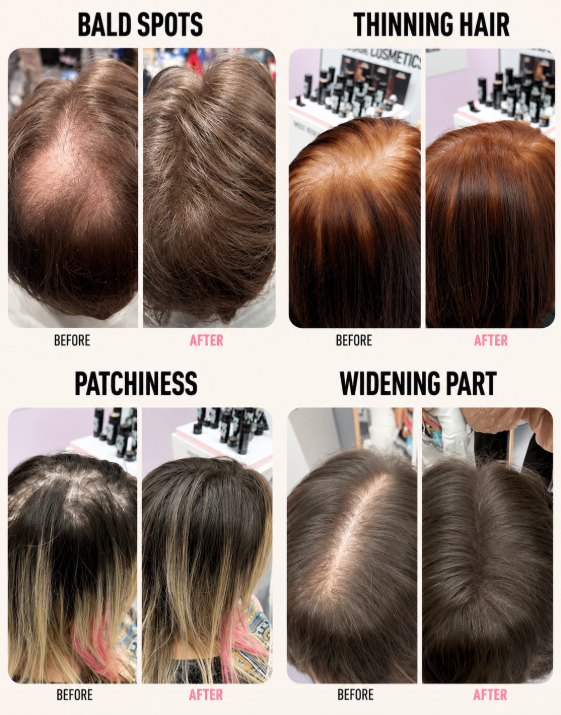Seamless Injected Invisible Tape In Hair Extension -- 100% VIRGIN HUMAN HAIR (10 Pieces)