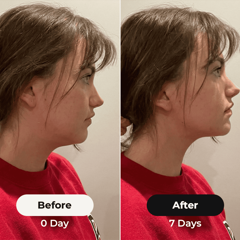 3-MINUTE THE FASTEST WAY TO SCULPT YOURFACE