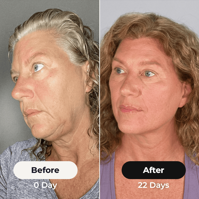3-MINUTE THE FASTEST WAY TO SCULPT YOURFACE
