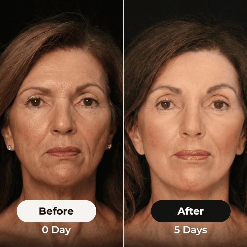 3-MINUTE THE FASTEST WAY TO SCULPT YOURFACE