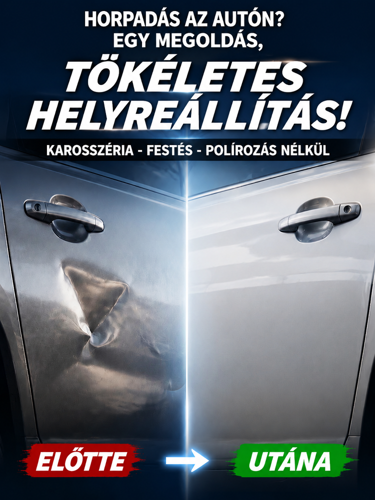 [-80% Akció]3 Másodperces Vákuumos Horpadásjavító | 100% Fényezésvédelem & Nincs Szervizdíj 