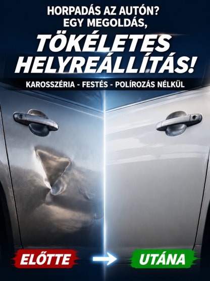 [-80% Akció]3 Másodperces Vákuumos Horpadásjavító | 100% Fényezésvédelem & Nincs Szervizdíj 