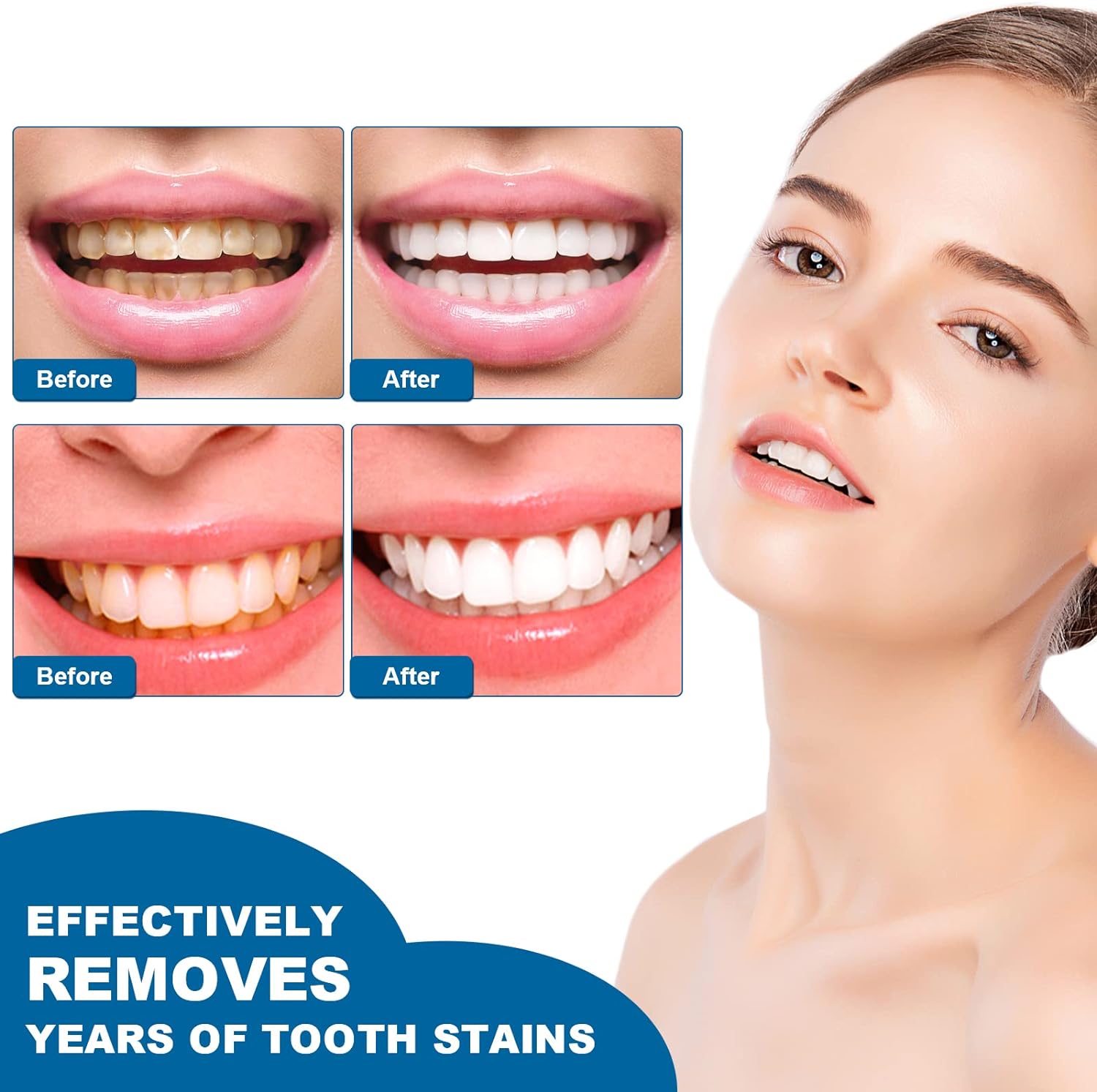 Teeth Whitening Essence