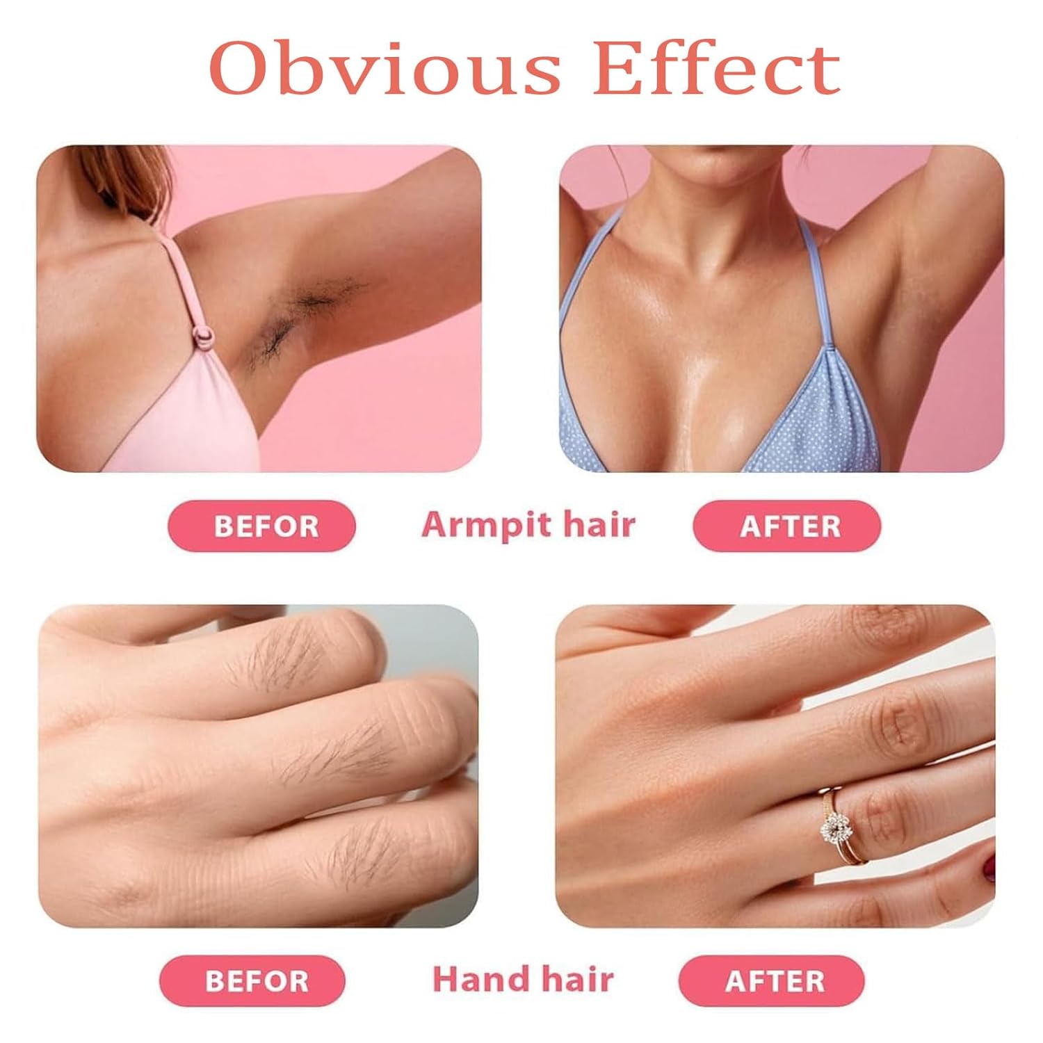 Hair Removal Kit