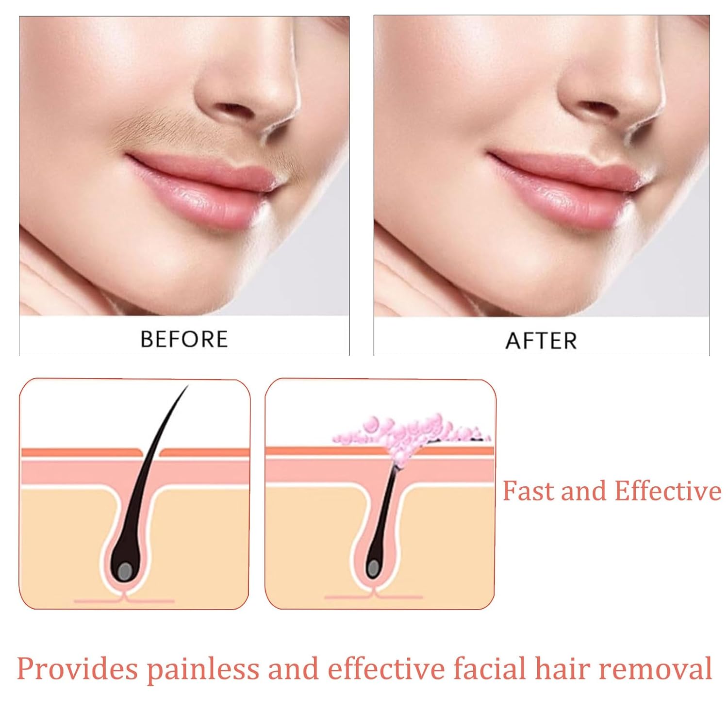 Hair Removal Kit