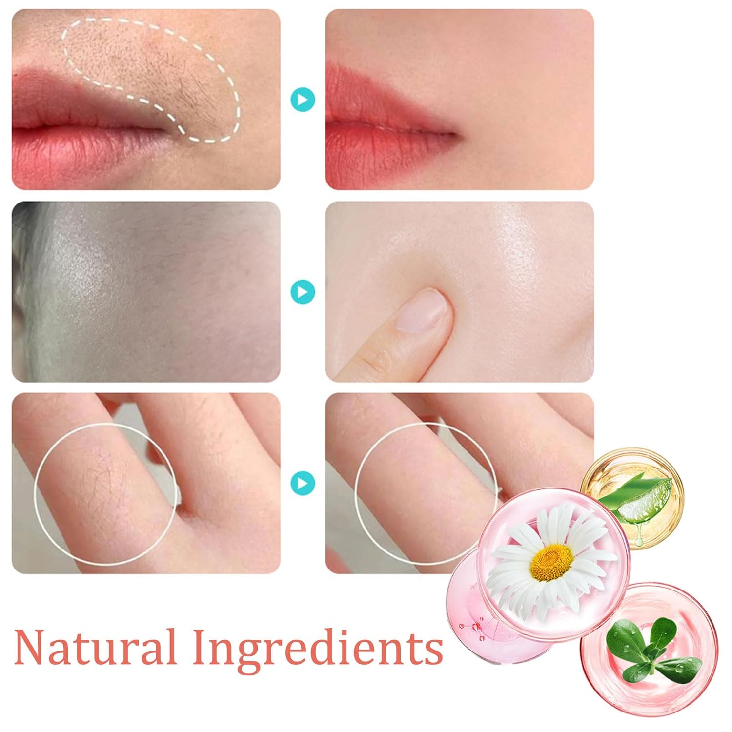 Hair Removal Kit