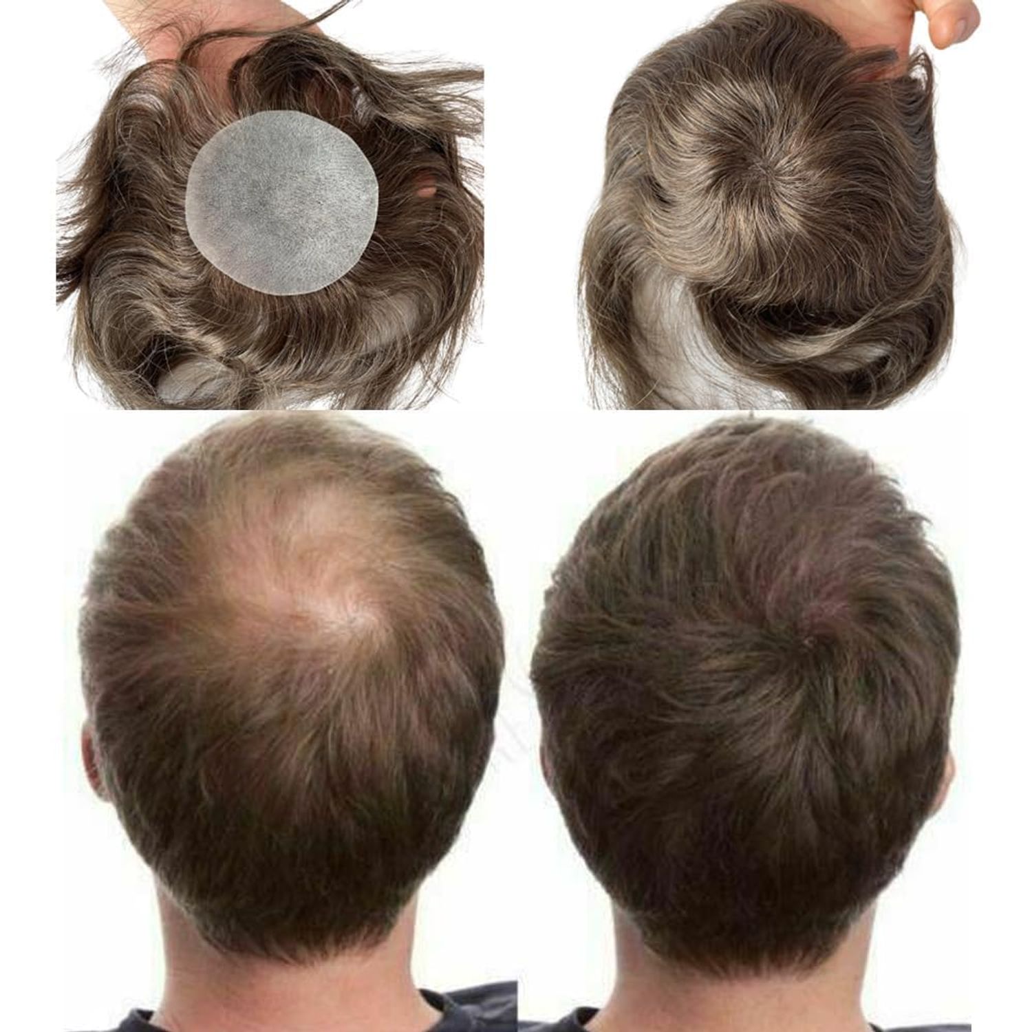 Voloria Bald Spot Hair Patch Toupee for Men 3.15x3.15inches Full PU Skin Base Cover-up Hair Patches Pieces Human Hair Topper Reaplcement Systems Hairpiece (#4 Light Brown Color)