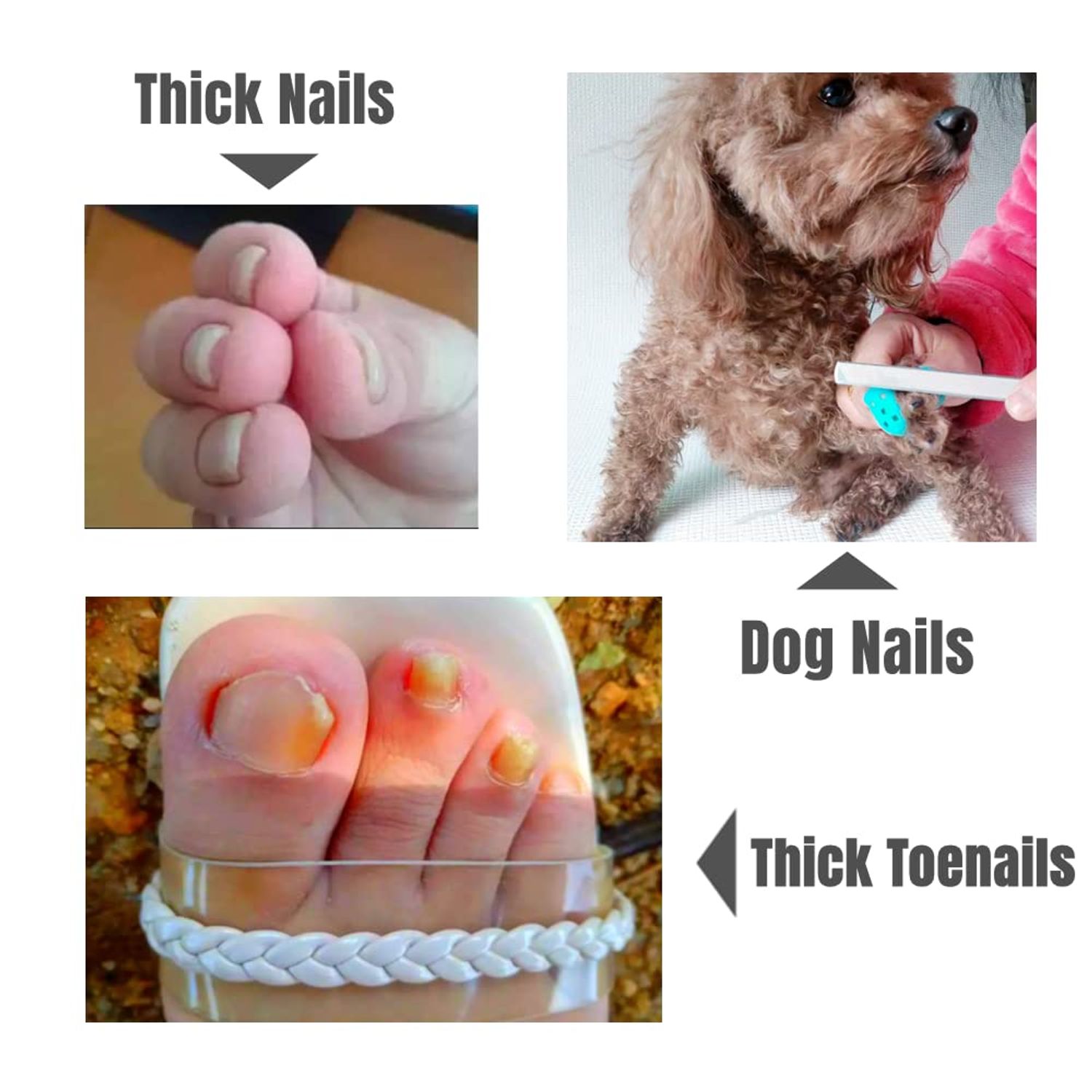 IDOU 2 Pieces Toe Nail Files for Thick Nails,Stainless Steel Nail File 4 sides,Dog Nail File for Men Seniors & Dogs