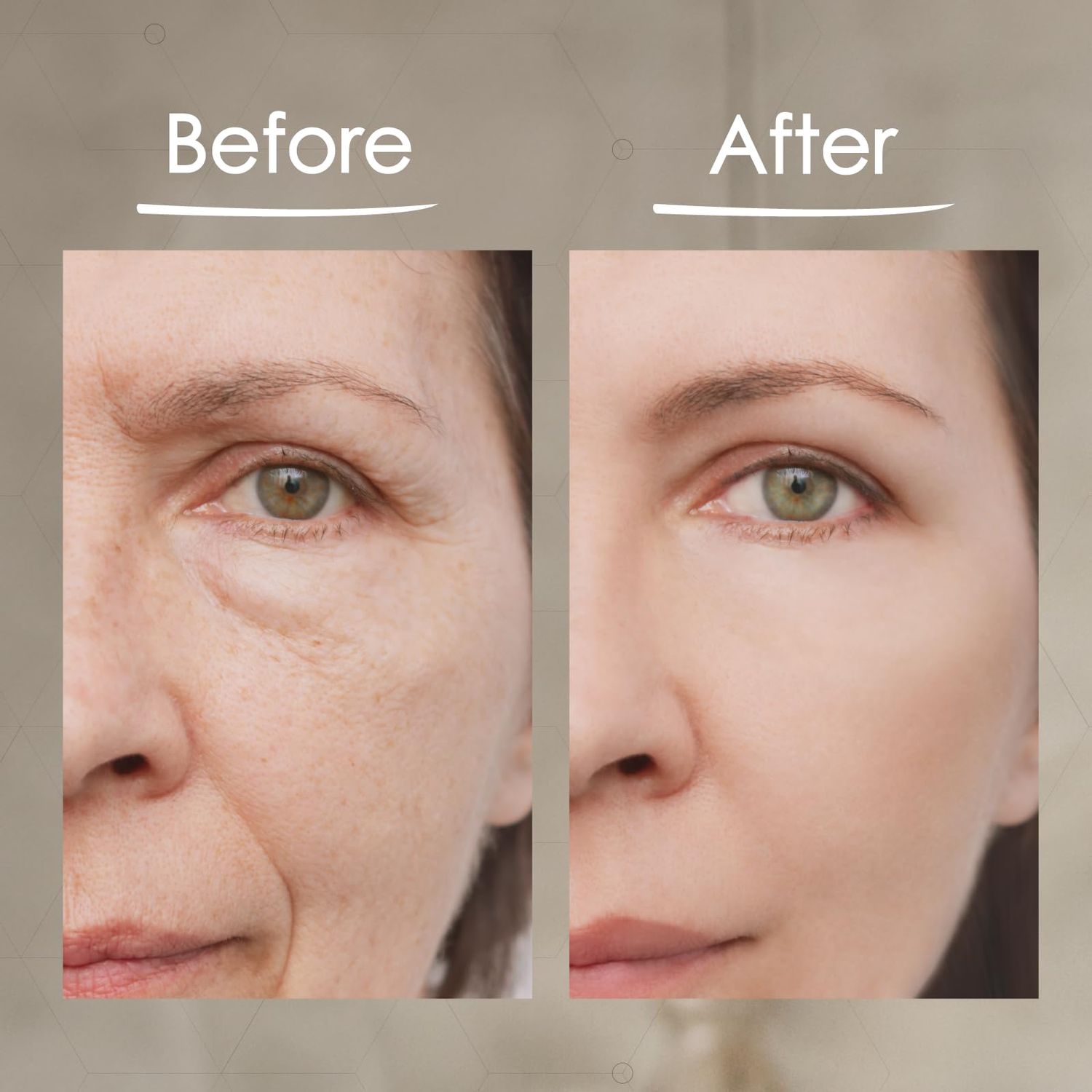 BioLogic Solutions MaxiLift Serum, Instant Face Lift Cream, Skin Tightening Serum for Face & Instant Eye Lift, Smooth & Firm Loose Sagging Skin, Fine Lines & Wrinkles Within 2 Minutes, 0.5 Fl Oz