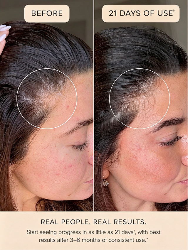 HAIR PROTEIN