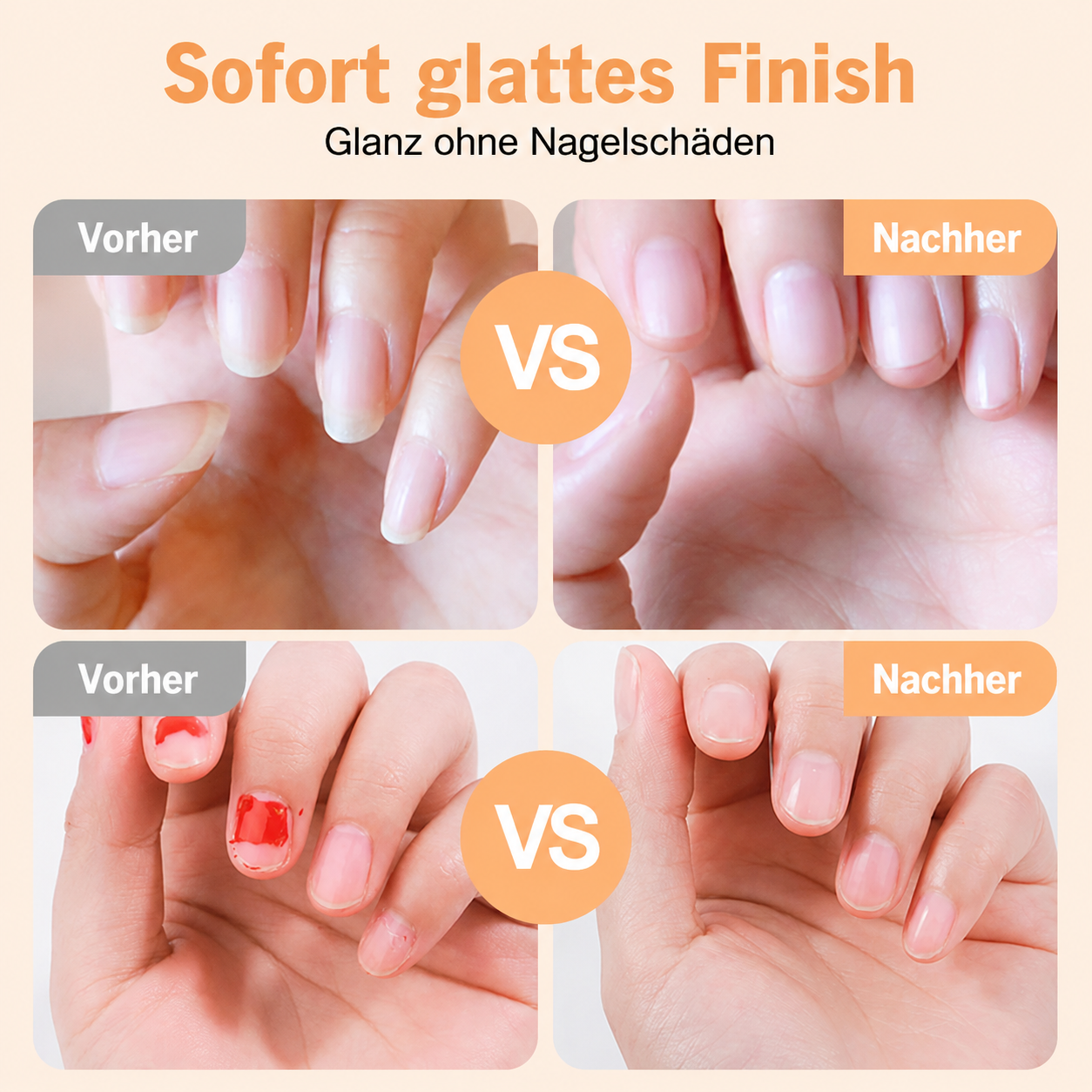 🔥NUR HEUTE: 50 % 🌟 2-in-1-Smart-Elektronagelschere & -Polierer ✂️💅 Die elektrische Nagelpflege für die ganze Familie!