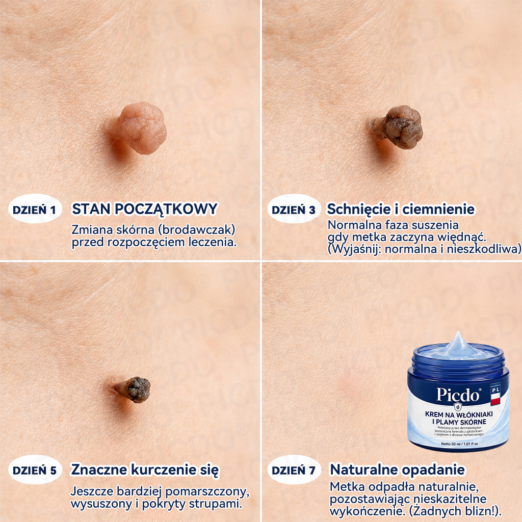  𝐏𝐢𝐜𝐝𝐨® 7-𝐃𝐧𝐢𝐨𝐰𝐲 𝐊𝐫𝐞𝐦 𝐝𝐨 𝐔𝐬𝐮𝐰𝐚𝐧𝐢𝐚 𝐁𝐫𝐨𝐝𝐚𝐰𝐞𝐤 𝐢 𝐍𝐢𝐞𝐝𝐨𝐬𝐤𝐨𝐧𝐚𝐥𝐨ś𝐜𝐢 𝐒𝐤ó𝐫𝐲🩵 (𝑭𝒐𝒓𝒎𝒖ł𝒂 𝑩𝒆𝒛 𝑩ó𝒍𝒖 𝒊 𝑩𝒆𝒛 𝑩𝒍𝒊𝒛𝒏) 💪