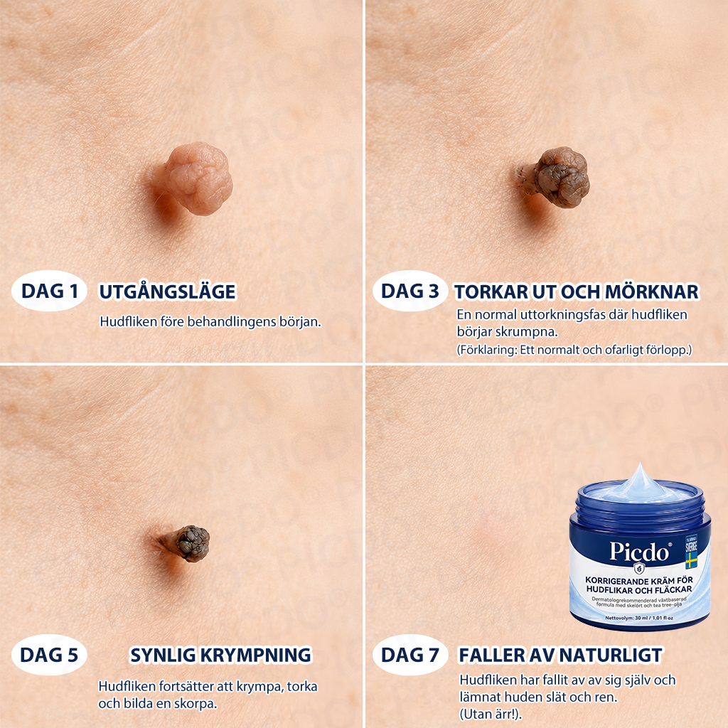 𝐏𝐢𝐜𝐝𝐨® 7-dagars Hudfliks- & Fläckborttagningskräm (Noll Smärta, Noll Ärr Formula) 🌹