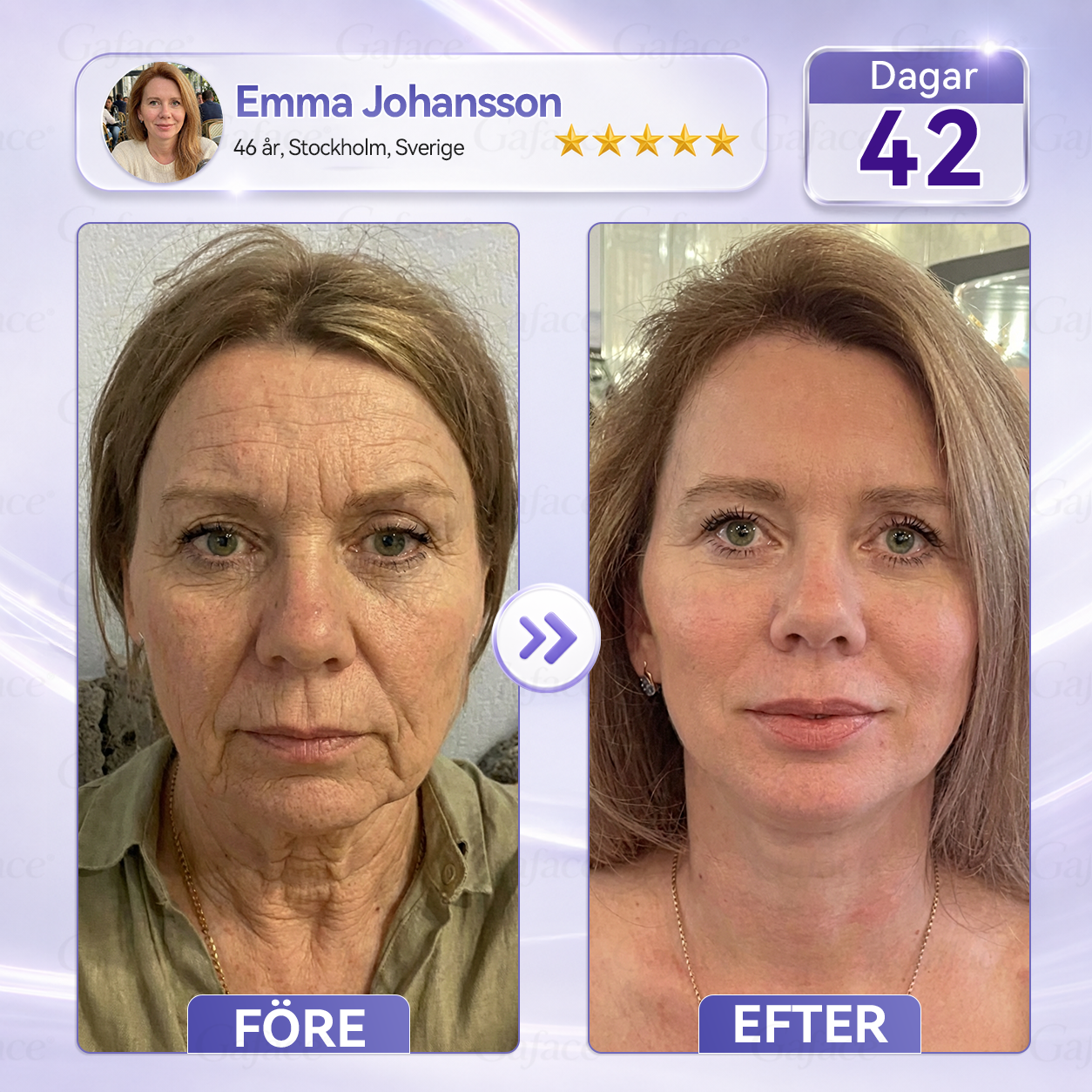 🎯🌸 𝐆𝐚𝐟𝐚𝐜𝐞® 𝐊𝐨𝐥𝐥𝐚𝐠𝐞𝐧- 𝐨𝐜𝐡 𝐅𝐮𝐥𝐥𝐞𝐫𝐞𝐧 𝐔𝐩𝐩𝐬𝐭𝐫𝐚𝐦𝐚𝐧𝐝𝐞 𝐑𝐨𝐥𝐥-𝐨𝐧-𝐤𝐫ä𝐦