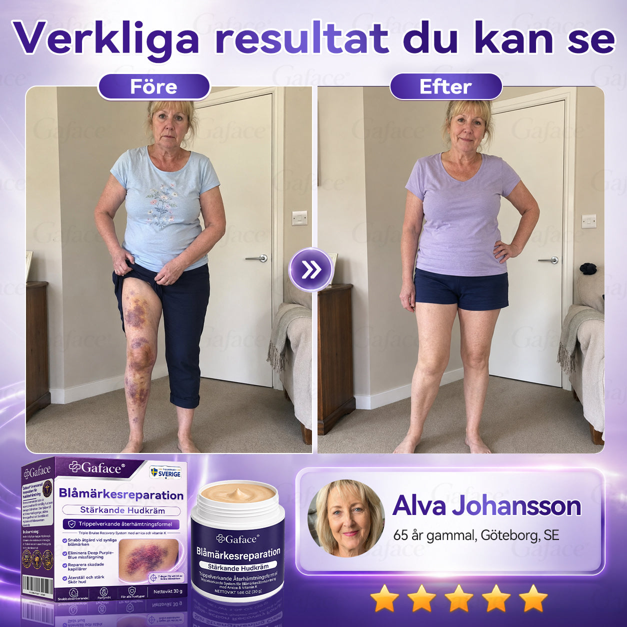 👩‍⚕️💚[110𝑲+ 𝑺Å𝑳𝑫𝑨] ✨𝑮𝒂𝒇𝒂𝒄𝒆® 𝑩𝒍å𝒎ä𝒓𝒌𝒆𝒔𝒓𝒆𝒑𝒂𝒓𝒂𝒕𝒊𝒐𝒏 𝑺𝒕ä𝒓𝒌𝒂𝒏𝒅𝒆 𝑯𝒖𝒅𝒌𝒓ä𝒎
