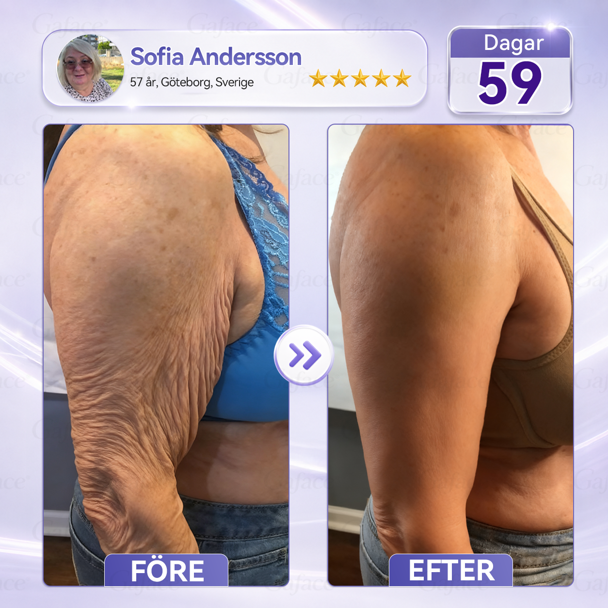 🎯🌸 𝐆𝐚𝐟𝐚𝐜𝐞® 𝐊𝐨𝐥𝐥𝐚𝐠𝐞𝐧- 𝐨𝐜𝐡 𝐅𝐮𝐥𝐥𝐞𝐫𝐞𝐧 𝐔𝐩𝐩𝐬𝐭𝐫𝐚𝐦𝐚𝐧𝐝𝐞 𝐑𝐨𝐥𝐥-𝐨𝐧-𝐤𝐫ä𝐦