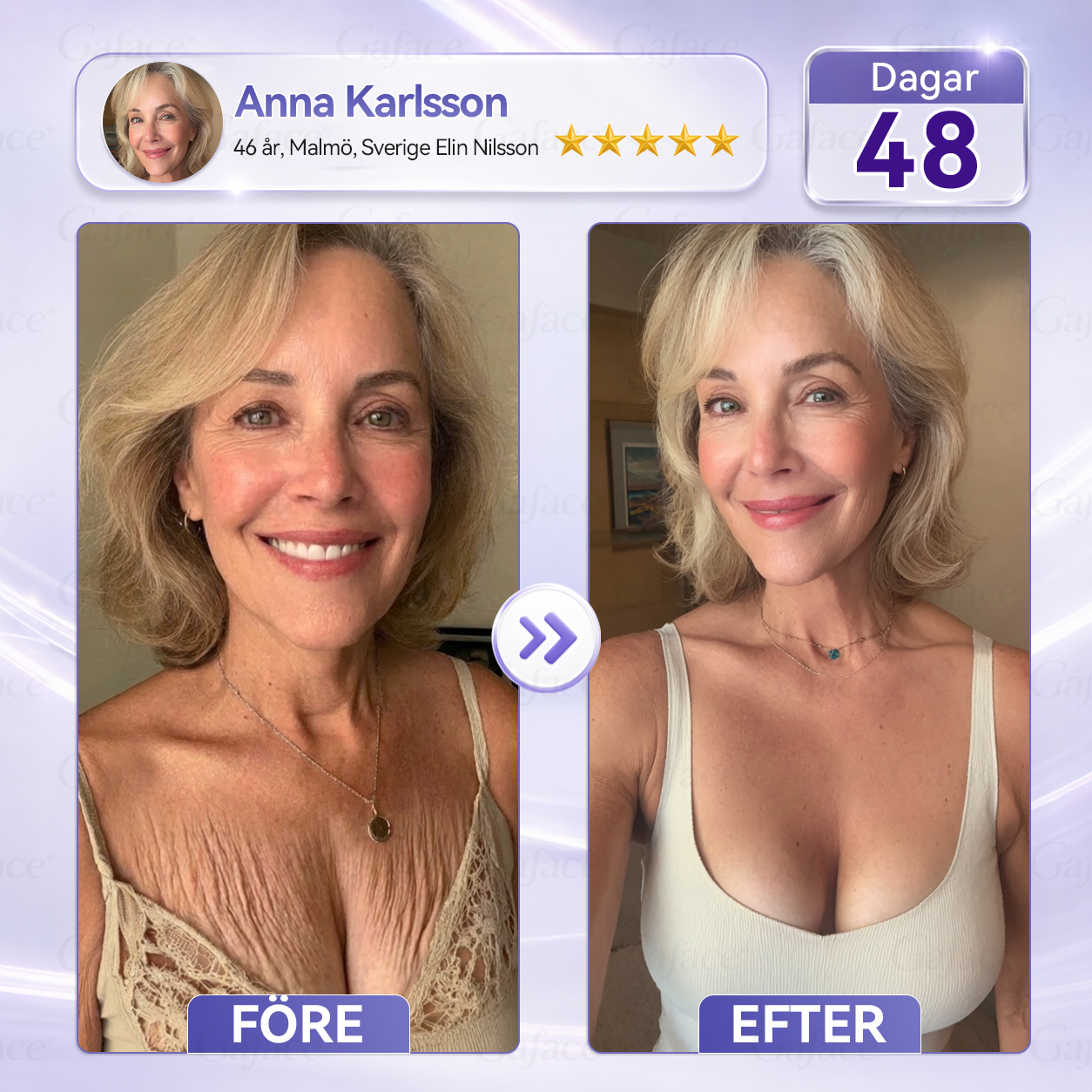 🎯🌸 𝐆𝐚𝐟𝐚𝐜𝐞® 𝐊𝐨𝐥𝐥𝐚𝐠𝐞𝐧- 𝐨𝐜𝐡 𝐅𝐮𝐥𝐥𝐞𝐫𝐞𝐧 𝐔𝐩𝐩𝐬𝐭𝐫𝐚𝐦𝐚𝐧𝐝𝐞 𝐑𝐨𝐥𝐥-𝐨𝐧-𝐤𝐫ä𝐦