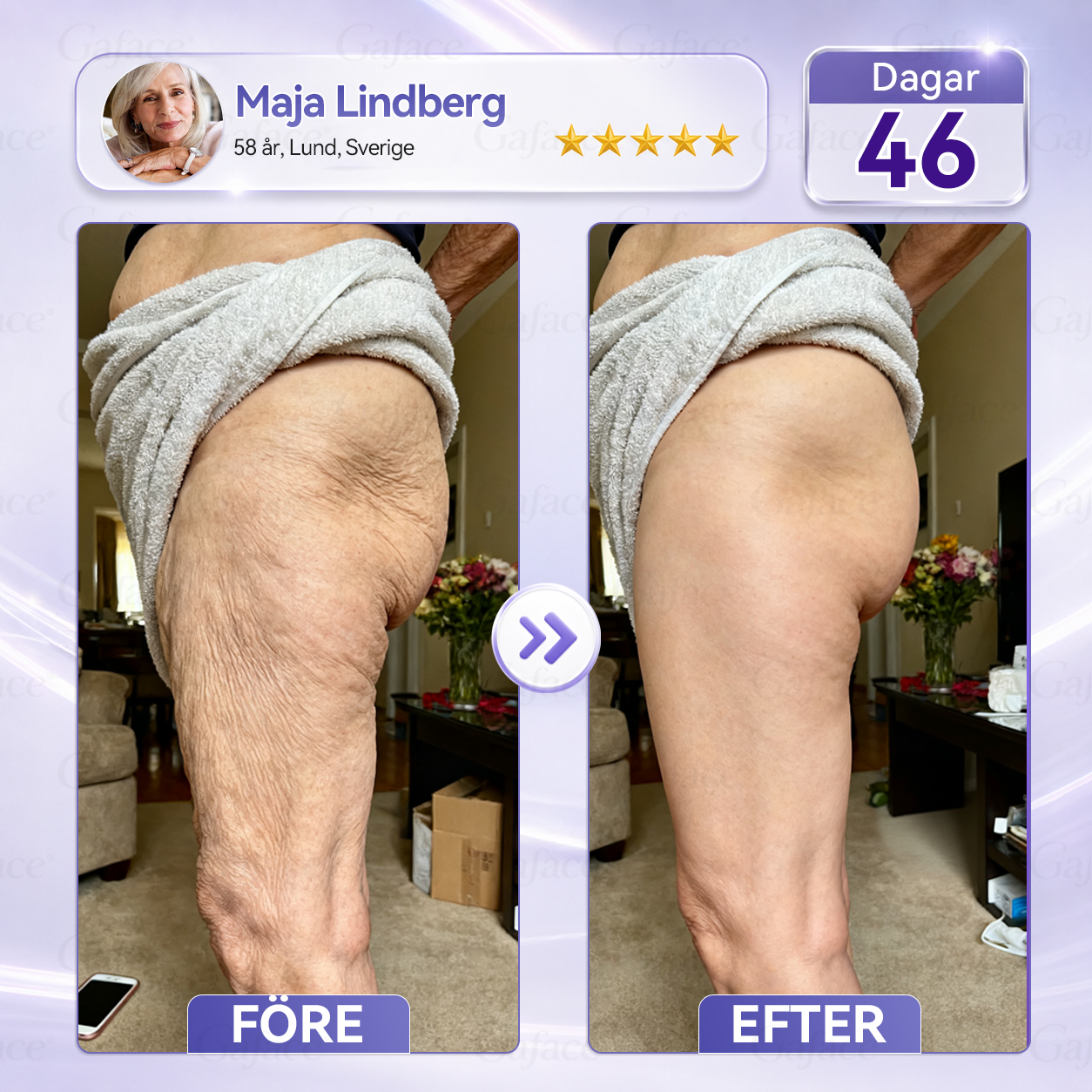 🎯🌸 𝐆𝐚𝐟𝐚𝐜𝐞® 𝐊𝐨𝐥𝐥𝐚𝐠𝐞𝐧- 𝐨𝐜𝐡 𝐅𝐮𝐥𝐥𝐞𝐫𝐞𝐧 𝐔𝐩𝐩𝐬𝐭𝐫𝐚𝐦𝐚𝐧𝐝𝐞 𝐑𝐨𝐥𝐥-𝐨𝐧-𝐤𝐫ä𝐦