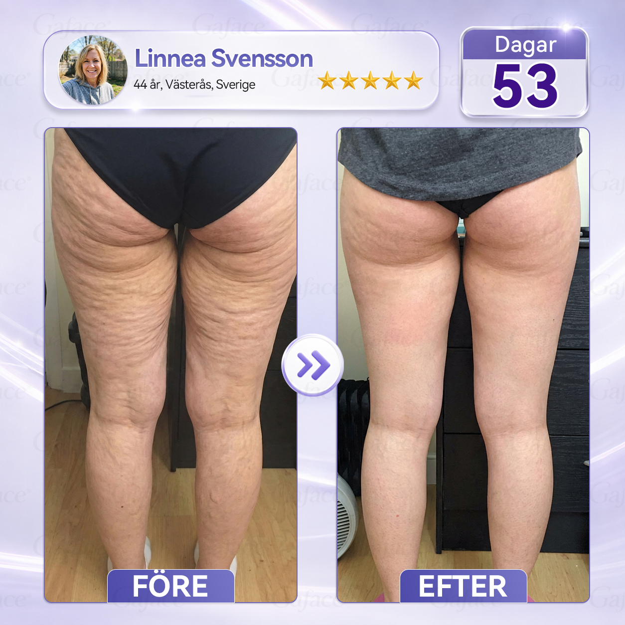 🎯🌸 𝐆𝐚𝐟𝐚𝐜𝐞® 𝐊𝐨𝐥𝐥𝐚𝐠𝐞𝐧- 𝐨𝐜𝐡 𝐅𝐮𝐥𝐥𝐞𝐫𝐞𝐧 𝐔𝐩𝐩𝐬𝐭𝐫𝐚𝐦𝐚𝐧𝐝𝐞 𝐑𝐨𝐥𝐥-𝐨𝐧-𝐤𝐫ä𝐦