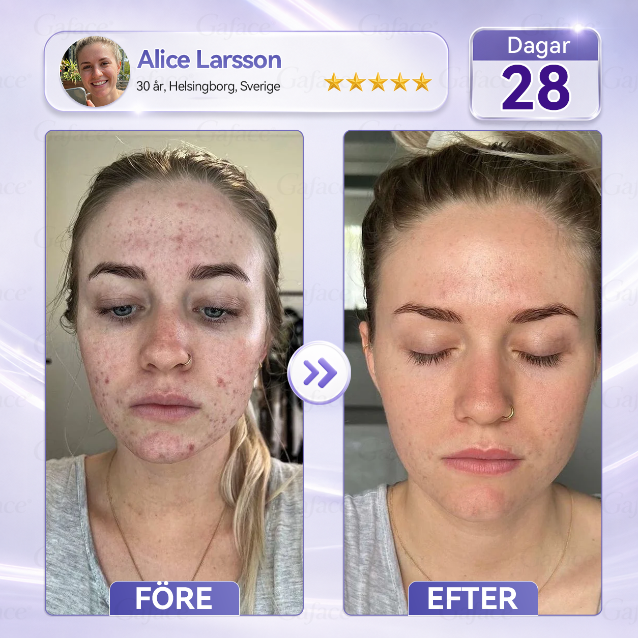 🎯🌸 𝐆𝐚𝐟𝐚𝐜𝐞® 𝐊𝐨𝐥𝐥𝐚𝐠𝐞𝐧- 𝐨𝐜𝐡 𝐅𝐮𝐥𝐥𝐞𝐫𝐞𝐧 𝐔𝐩𝐩𝐬𝐭𝐫𝐚𝐦𝐚𝐧𝐝𝐞 𝐑𝐨𝐥𝐥-𝐨𝐧-𝐤𝐫ä𝐦