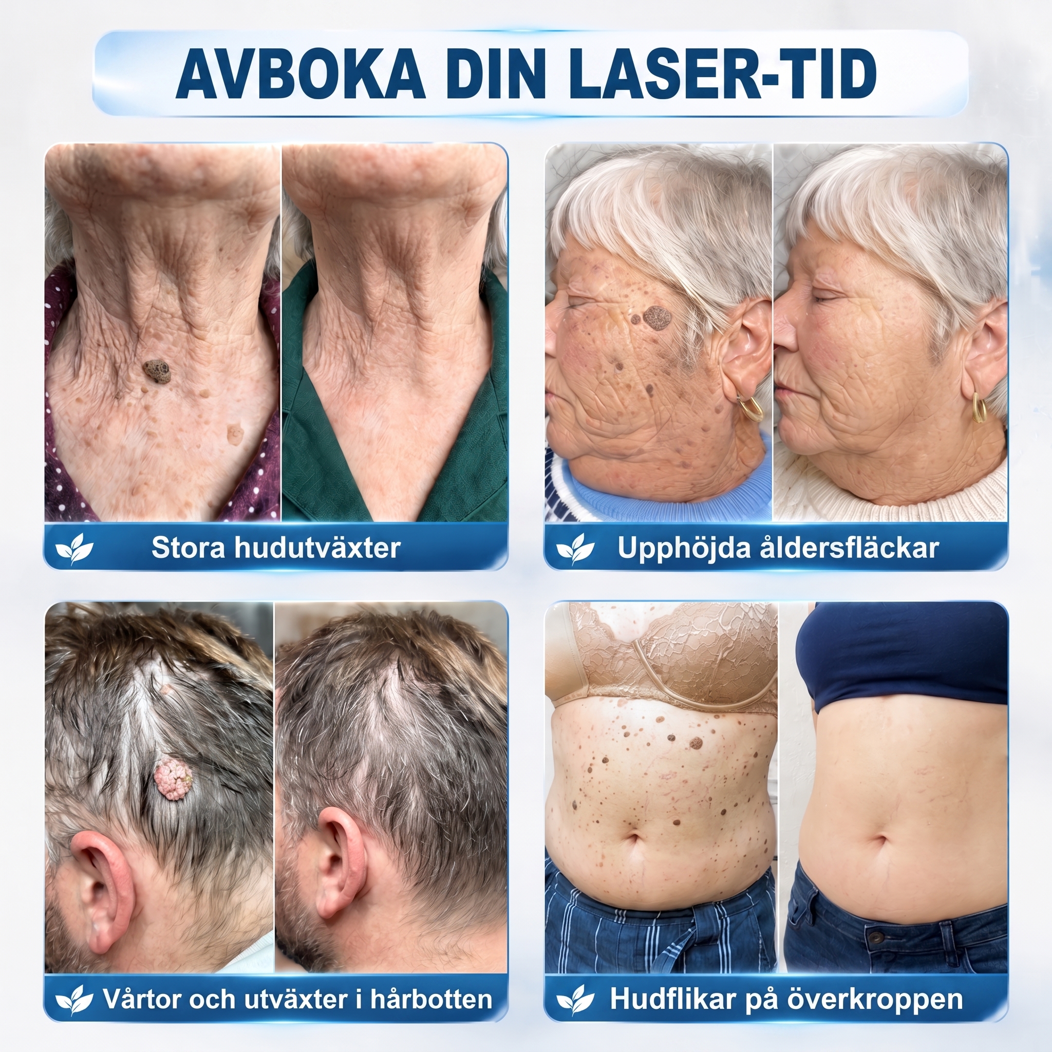 𝐎𝐟𝐟𝐢𝐜𝐢𝐚𝐥 𝐁𝐫𝐚𝐧𝐝 𝐒𝐭𝐨𝐫𝐞 |🔥𝐏i𝐜𝐝o® 7-𝐷𝑎𝑦 𝗧𝐚𝐠 & 𝗦𝗽𝐨𝐭 𝐄𝐫𝒂𝒔𝒆𝒓(Zero Pain, Zero 𝐒𝐜𝐚𝒓𝒔 Rollerball)💎