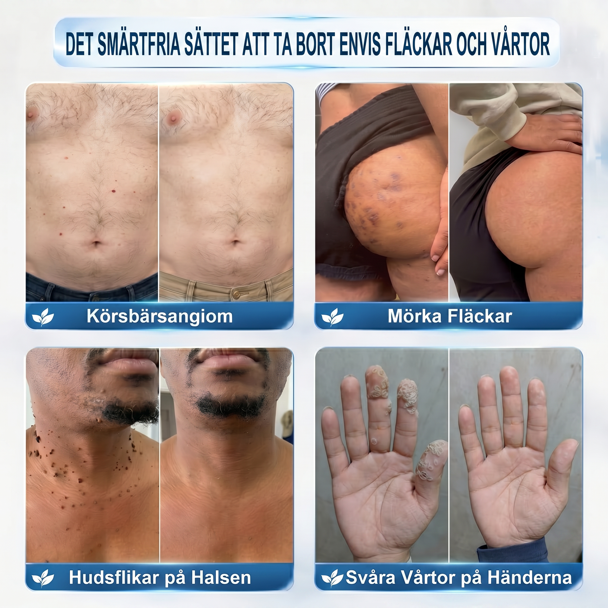 𝐎𝐟𝐟𝐢𝐜𝐢𝐚𝐥 𝐁𝐫𝐚𝐧𝐝 𝐒𝐭𝐨𝐫𝐞 |🔥𝐏i𝐜𝐝o® 7-𝐷𝑎𝑦 𝗧𝐚𝐠 & 𝗦𝗽𝐨𝐭 𝐄𝐫𝒂𝒔𝒆𝒓(Zero Pain, Zero 𝐒𝐜𝐚𝒓𝒔 Rollerball)💎