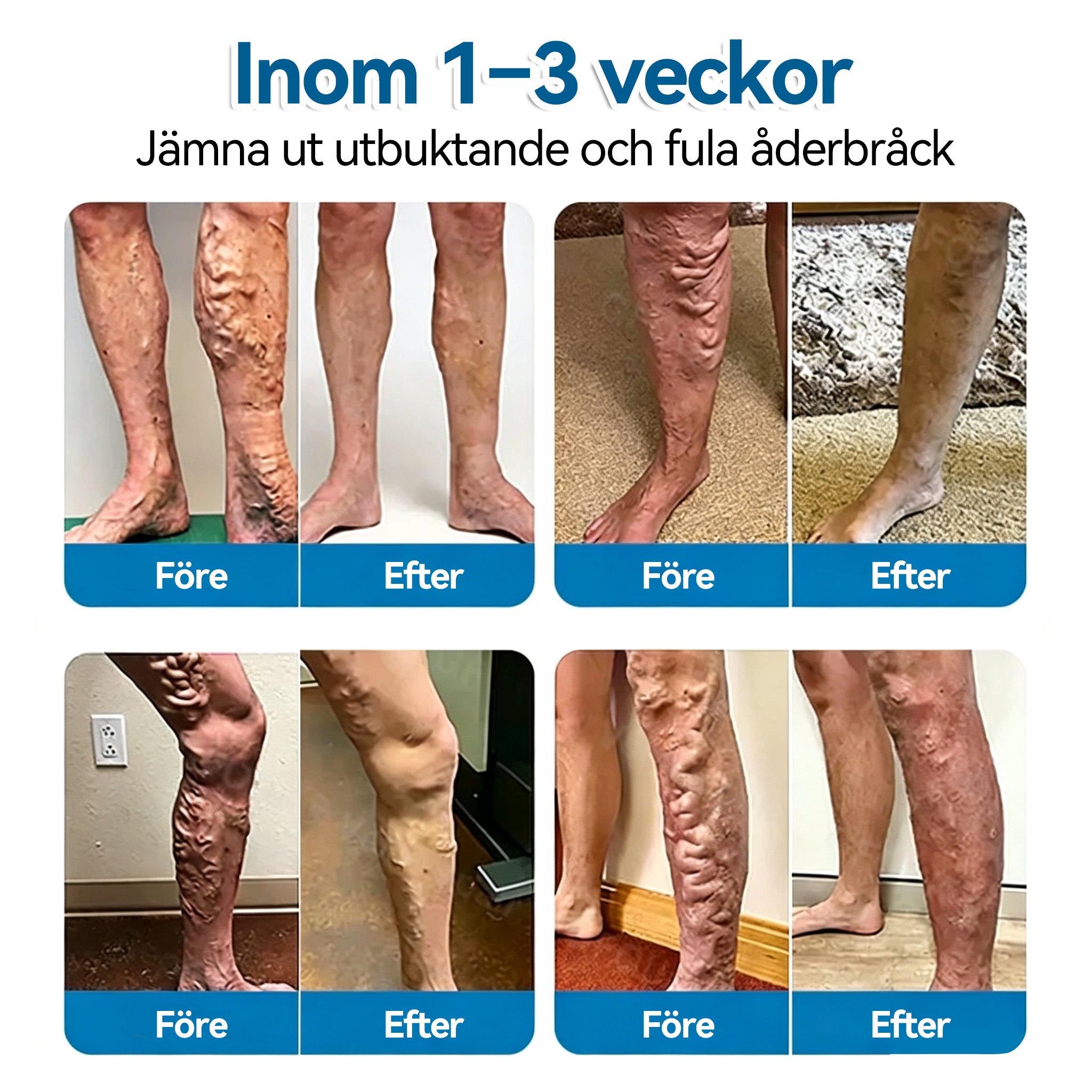🍁💖𝐅𝐥𝐨𝐫𝐢𝐬𝐦𝐚®Å𝐝𝐞𝐫𝐫𝐞𝐩𝐚𝐫𝐚𝐭𝐢𝐨𝐧 𝐑𝐮𝐥𝐥𝐞 𝐌𝐞𝐝 𝐌𝐢𝐤𝐫𝐨𝐧å𝐥𝐬𝐩𝐥å𝐬𝐭𝐞𝐫 Omedelbar lindring, långsiktiga resultat