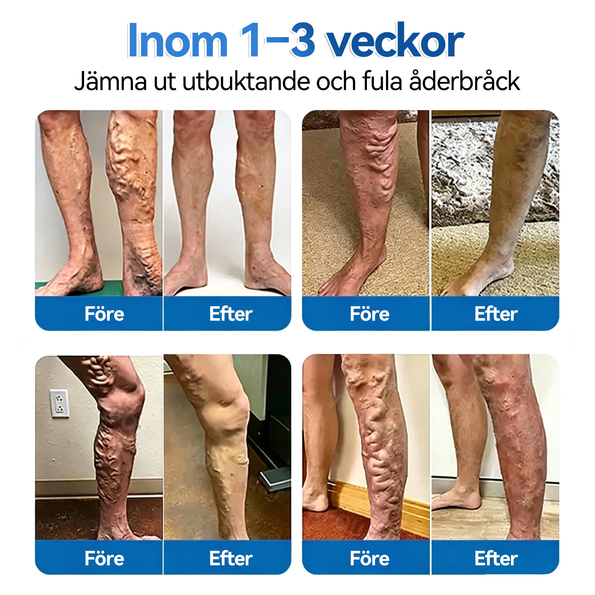 🍁💖𝐅𝐥𝐨𝐫𝐢𝐬𝐦𝐚®Å𝐝𝐞𝐫𝐫𝐞𝐩𝐚𝐫𝐚𝐭𝐢𝐨𝐧 𝐑𝐮𝐥𝐥𝐞 𝐌𝐞𝐝 𝐌𝐢𝐤𝐫𝐨𝐧å𝐥𝐬𝐩𝐥å𝐬𝐭𝐞𝐫 Omedelbar lindring, långsiktiga resultat