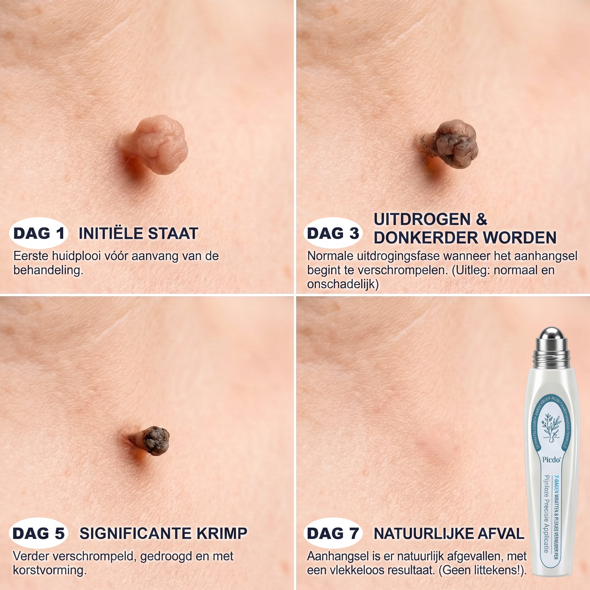 𝐎𝐟𝐟𝐢𝐜𝐢ë𝐥𝐞 𝐦𝐞𝐫𝐤𝐬𝐡𝐨𝐩 ✅𝐏𝐢𝐜𝐝𝐨®𝟕-𝐃𝐀𝐆𝐄𝐍 𝐖𝐫𝐚𝐭𝐭𝐞𝐧 & 𝐏𝐥𝐞𝐤𝐣𝐞𝐬 𝐕𝐞𝐫𝐰𝐢𝐣𝐝𝐞𝐫𝐚𝐚𝐫(Pijnloze rollerball die geen sporen achterlaat , Klarna beschikbaar)🍥