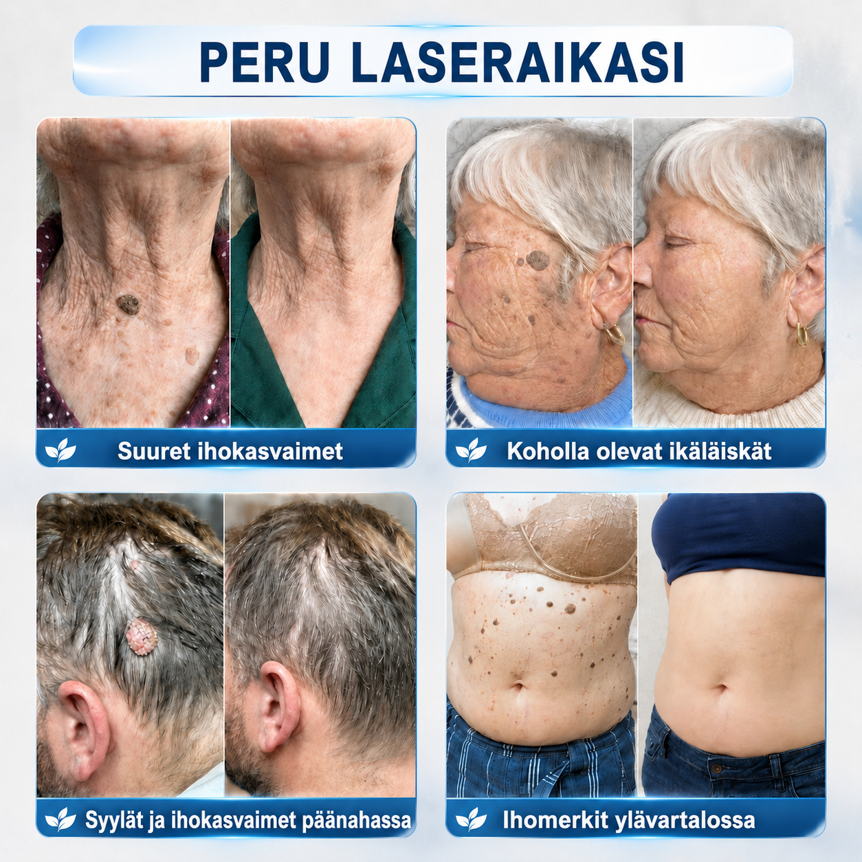 🇫🇮👩‍⚕️🎁 𝐕𝐢𝐫𝐚𝐥𝐥𝐢𝐧𝐞𝐧 𝐯𝐞𝐫𝐤𝐤𝐨𝐤𝐚𝐮𝐩𝐩𝐚| 𝑵𝐞𝒌𝐢𝐬𝐬® 🌿 𝐊𝐚𝐬𝐯𝐢𝐩𝐨𝐡𝐣𝐚𝐢𝐧𝐞𝐧 𝐦𝐢𝐤𝐫𝐨𝐧𝐞𝐮𝐥𝐚𝐡𝐲𝐝𝐫𝐨𝐤𝐨𝐥𝐥𝐨𝐢𝐝𝐢𝐥𝐚𝐚𝐬𝐭𝐚𝐫𝐢 