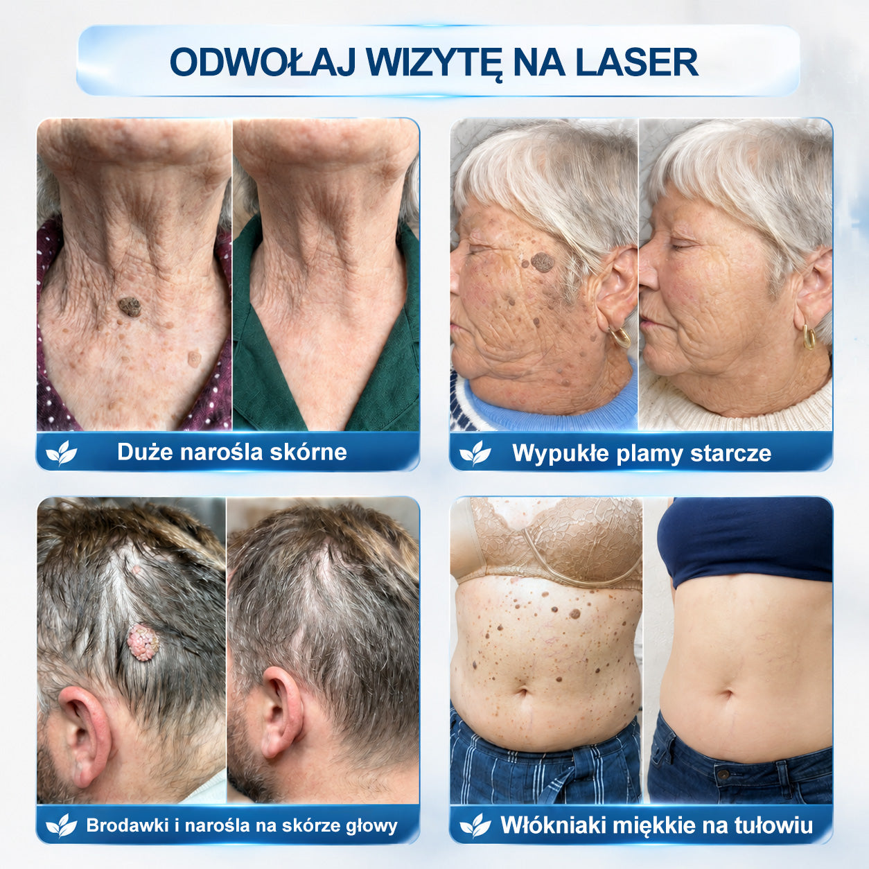 𝐏i𝐜𝐝o® 7 𝑫𝒏𝒊 𝑷𝒓𝒆𝒑𝒂𝒓𝒂𝒕 𝑫𝒐 𝑼𝒔𝒖𝒘𝒂𝒏𝒊𝒂 𝑾łó𝒌𝒏𝒊𝒂𝒌ó𝒘 𝑴𝒊ę𝒌𝒌𝒊𝒄𝒉 𝑰 𝑷𝒓𝒛𝒆𝒃𝒂𝒓𝒘𝒊𝒆ń(𝐁𝐞𝐳 𝐁ó𝐥𝐮, 𝐁𝐞𝐳 𝐁𝐥𝐢𝐳𝐧 – 𝐑𝐨𝐥𝐥-𝐨𝐧)💪