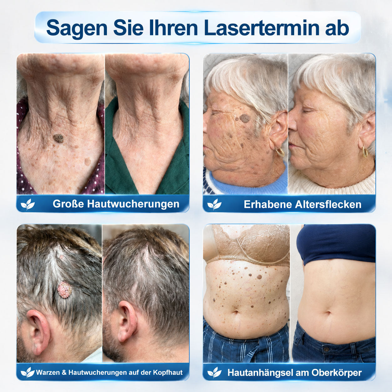 🇩🇪𝐎𝐟𝐟𝑖𝑧𝑖𝒆𝒍𝒍𝒆𝒓 𝑴𝒂𝗋𝗄𝖾𝗇𝘴𝘵𝘰𝘳𝘦|✅𝗣𝗶𝒄𝒅𝐨® 𝟕-𝑇𝖺𝗀𝗲 𝐹𝑙𝖾𝖼𝘬𝘦𝘯- & 𝑯𝖺𝒖𝗍𝖺𝗇𝗁ä𝘯𝘨𝘴𝘦𝘭-𝐸𝑛𝑡𝖿𝖾𝗋𝘯𝘦𝘳 (Schmerzfrei, Narbenfrei Rollerball)🎉