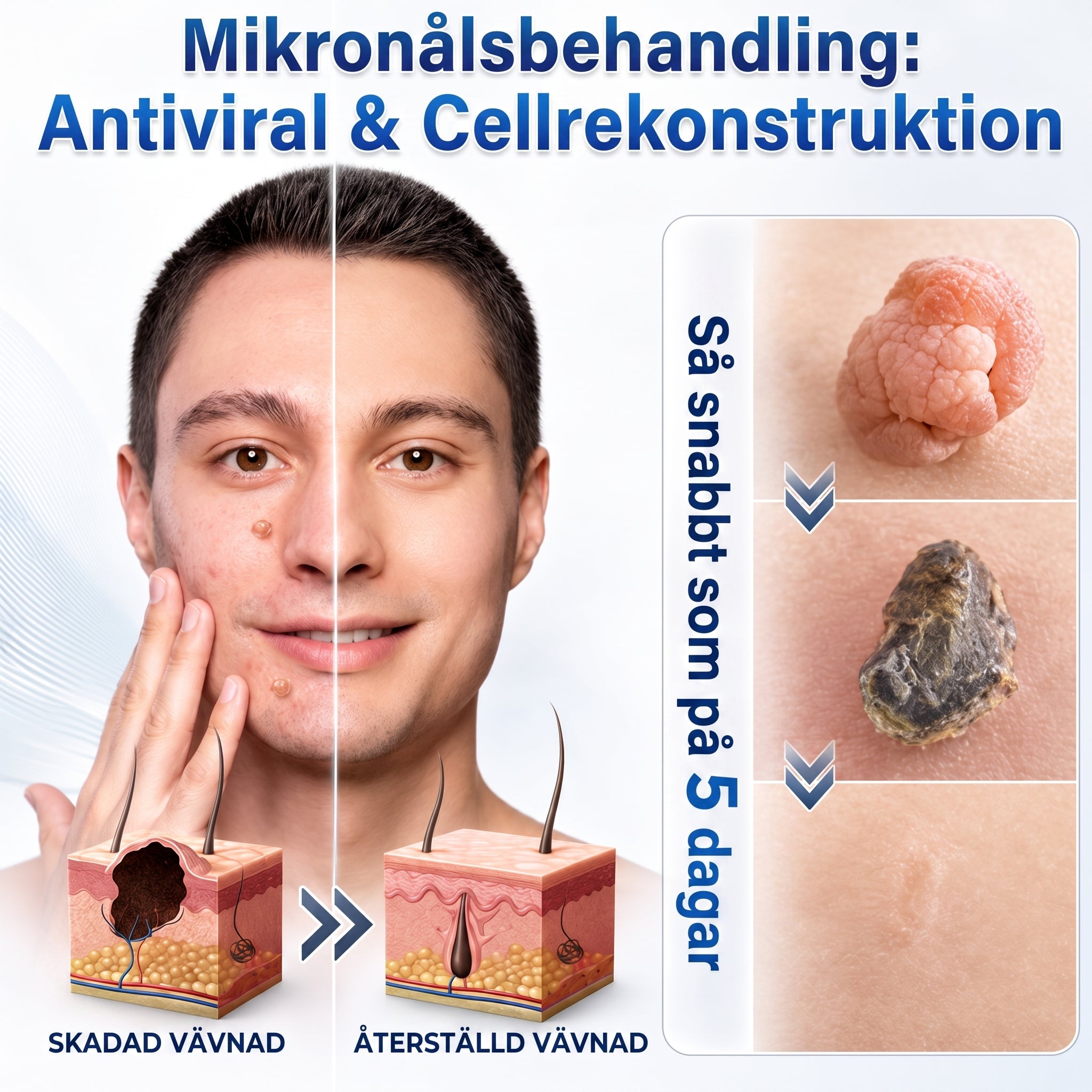 👩‍⚕️Officiell butik | 𝑵𝐞𝒌𝐢𝐬𝐬® 🌿 𝑴𝒊𝒌𝒓𝒐𝒏å𝒍 𝑭𝒆𝒍𝒇𝒓𝒊 𝑯𝒖𝒅 𝑩𝒐𝒓𝒕𝒕𝒂𝒈𝒏𝒊𝒏𝒈 𝑨𝒗 𝑽å𝒓𝒕𝒐𝒓 𝑷𝒍å𝒔𝒕𝒆𝒓 (𝐹ö𝑟 ℎ𝑢𝑑𝑓𝑙𝑖𝑘𝑎𝑟, 𝑠𝑚å ℎ𝑢𝑑𝑢𝑡𝑣ä𝑥𝑡𝑒𝑟, 𝑣å𝑟𝑡𝑜𝑟, 𝑓ö𝑑𝑒𝑙𝑠𝑒𝑚ä𝑟𝑘𝑒𝑛, å𝑙𝑑𝑒𝑟𝑠𝑓𝑙ä𝑐𝑘𝑎𝑟 𝑜𝑐ℎ 𝑝𝑖𝑔𝑚𝑒𝑛𝑡𝑒𝑟𝑖𝑛𝑔𝑠𝑝𝑟𝑜𝑏𝑙𝑒𝑚)