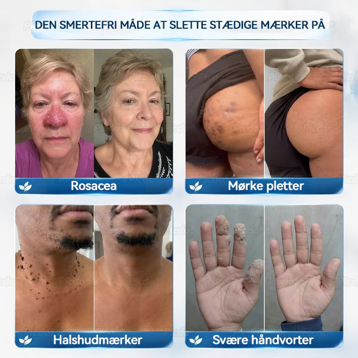 🪅🪙𝐏i𝐜𝐝o®7-𝑫𝒂𝒈𝒆𝒔 𝑯𝒖𝒅𝒗æ𝒌𝒔𝒕 𝑶𝒈 𝑷𝒊𝒈𝒎𝒆𝒏𝒕𝒑𝒍𝒆𝒕𝒕𝒆𝒓 𝑭𝒋𝒆𝒓𝒏 𝑷𝒆𝒏𝒏𝒆𝒏(Nul smerte, nul ar Rollerball)💪