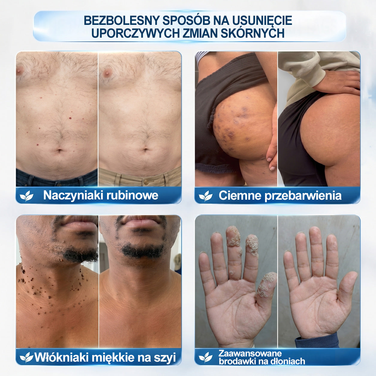 𝐏i𝐜𝐝o® 7 𝑫𝒏𝒊 𝑷𝒓𝒆𝒑𝒂𝒓𝒂𝒕 𝑫𝒐 𝑼𝒔𝒖𝒘𝒂𝒏𝒊𝒂 𝑾łó𝒌𝒏𝒊𝒂𝒌ó𝒘 𝑴𝒊ę𝒌𝒌𝒊𝒄𝒉 𝑰 𝑷𝒓𝒛𝒆𝒃𝒂𝒓𝒘𝒊𝒆ń(𝐁𝐞𝐳 𝐁ó𝐥𝐮, 𝐁𝐞𝐳 𝐁𝐥𝐢𝐳𝐧 – 𝐑𝐨𝐥𝐥-𝐨𝐧)💪