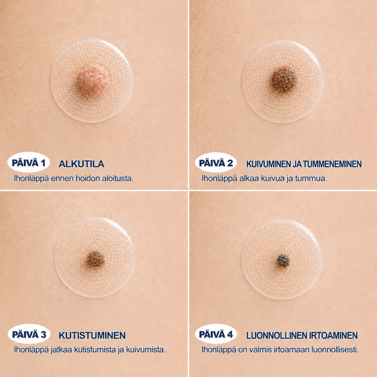 🇫🇮👩‍⚕️🎁 𝐕𝐢𝐫𝐚𝐥𝐥𝐢𝐧𝐞𝐧 𝐯𝐞𝐫𝐤𝐤𝐨𝐤𝐚𝐮𝐩𝐩𝐚| 𝑵𝐞𝒌𝐢𝐬𝐬® 🌿 𝐊𝐚𝐬𝐯𝐢𝐩𝐨𝐡𝐣𝐚𝐢𝐧𝐞𝐧 𝐦𝐢𝐤𝐫𝐨𝐧𝐞𝐮𝐥𝐚𝐡𝐲𝐝𝐫𝐨𝐤𝐨𝐥𝐥𝐨𝐢𝐝𝐢𝐥𝐚𝐚𝐬𝐭𝐚𝐫𝐢 