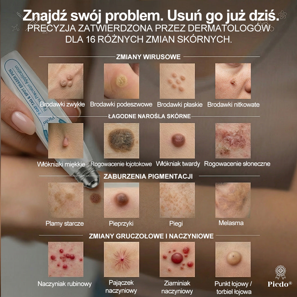 𝐏i𝐜𝐝o® 7 𝑫𝒏𝒊 𝑷𝒓𝒆𝒑𝒂𝒓𝒂𝒕 𝑫𝒐 𝑼𝒔𝒖𝒘𝒂𝒏𝒊𝒂 𝑾łó𝒌𝒏𝒊𝒂𝒌ó𝒘 𝑴𝒊ę𝒌𝒌𝒊𝒄𝒉 𝑰 𝑷𝒓𝒛𝒆𝒃𝒂𝒓𝒘𝒊𝒆ń(𝐁𝐞𝐳 𝐁ó𝐥𝐮, 𝐁𝐞𝐳 𝐁𝐥𝐢𝐳𝐧 – 𝐑𝐨𝐥𝐥-𝐨𝐧)💪