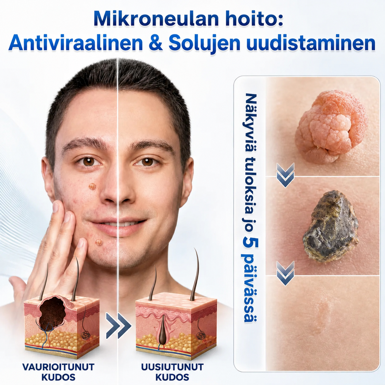 🇫🇮👩‍⚕️🎁 𝐕𝐢𝐫𝐚𝐥𝐥𝐢𝐧𝐞𝐧 𝐯𝐞𝐫𝐤𝐤𝐨𝐤𝐚𝐮𝐩𝐩𝐚| 𝑵𝐞𝒌𝐢𝐬𝐬® 🌿 𝐊𝐚𝐬𝐯𝐢𝐩𝐨𝐡𝐣𝐚𝐢𝐧𝐞𝐧 𝐦𝐢𝐤𝐫𝐨𝐧𝐞𝐮𝐥𝐚𝐡𝐲𝐝𝐫𝐨𝐤𝐨𝐥𝐥𝐨𝐢𝐝𝐢𝐥𝐚𝐚𝐬𝐭𝐚𝐫𝐢 