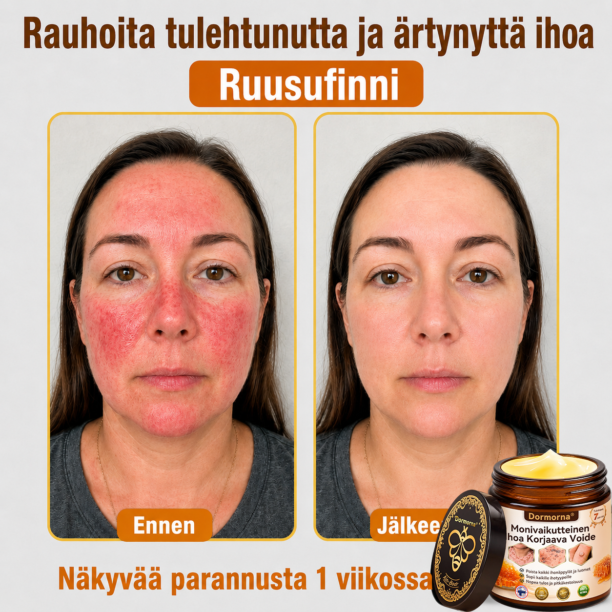📢🍀𝐷𝑜𝑟𝑚𝑜𝑟𝑛𝑎® 𝑀𝑜𝑛𝑖𝑣𝑎𝑖𝑘𝑢𝑡𝑡𝑒𝑖𝑛𝑒𝑛 𝐼ℎ𝑜𝑎 𝐾𝑜𝑟𝑗𝑎𝑎𝑣𝑎 𝑉𝑜𝑖𝑑𝑒🇫🇮
