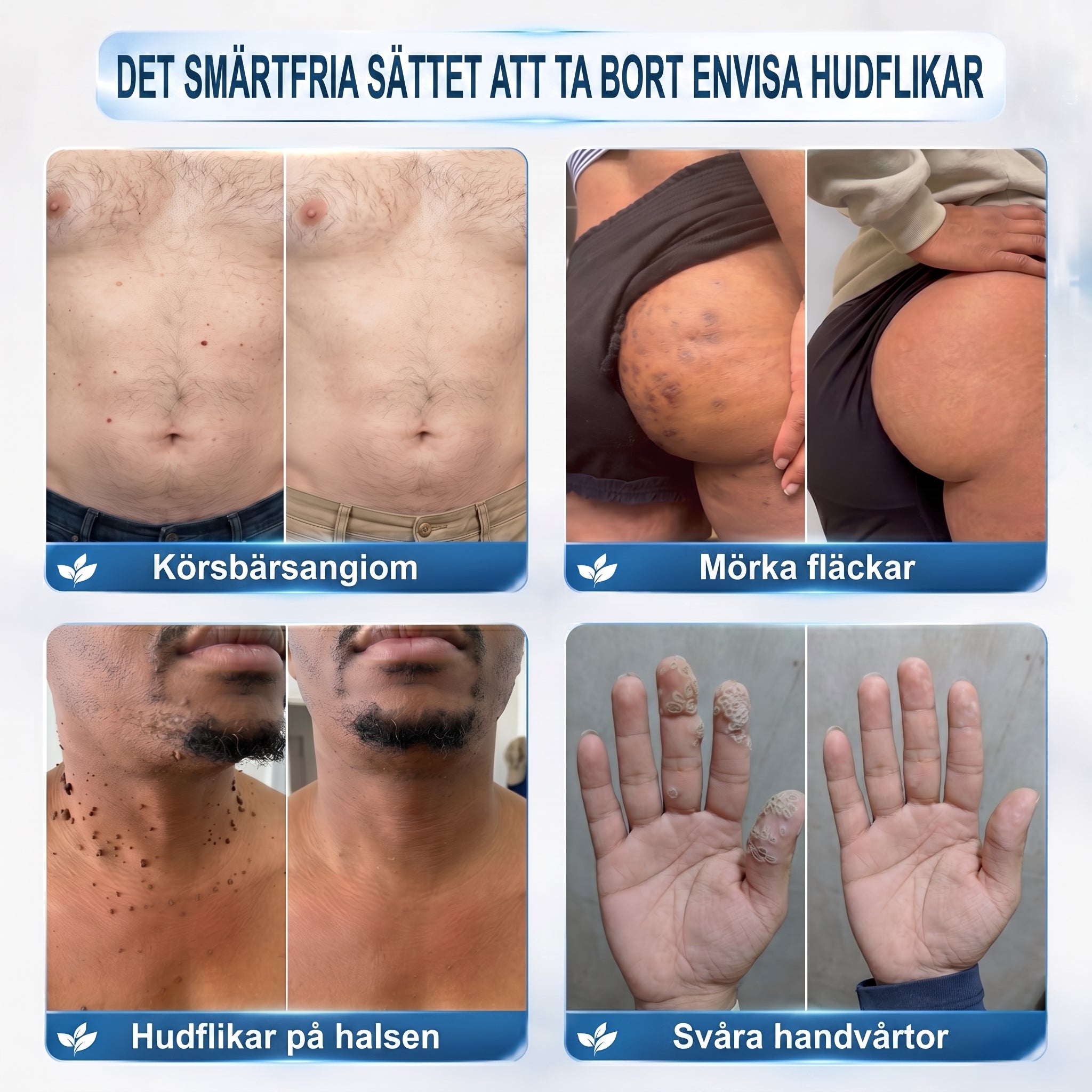 👩‍⚕️Officiell butik | 𝑵𝐞𝒌𝐢𝐬𝐬® 🌿 𝑴𝒊𝒌𝒓𝒐𝒏å𝒍 𝑭𝒆𝒍𝒇𝒓𝒊 𝑯𝒖𝒅 𝑩𝒐𝒓𝒕𝒕𝒂𝒈𝒏𝒊𝒏𝒈 𝑨𝒗 𝑽å𝒓𝒕𝒐𝒓 𝑷𝒍å𝒔𝒕𝒆𝒓 (𝐹ö𝑟 ℎ𝑢𝑑𝑓𝑙𝑖𝑘𝑎𝑟, 𝑠𝑚å ℎ𝑢𝑑𝑢𝑡𝑣ä𝑥𝑡𝑒𝑟, 𝑣å𝑟𝑡𝑜𝑟, 𝑓ö𝑑𝑒𝑙𝑠𝑒𝑚ä𝑟𝑘𝑒𝑛, å𝑙𝑑𝑒𝑟𝑠𝑓𝑙ä𝑐𝑘𝑎𝑟 𝑜𝑐ℎ 𝑝𝑖𝑔𝑚𝑒𝑛𝑡𝑒𝑟𝑖𝑛𝑔𝑠𝑝𝑟𝑜𝑏𝑙𝑒𝑚)