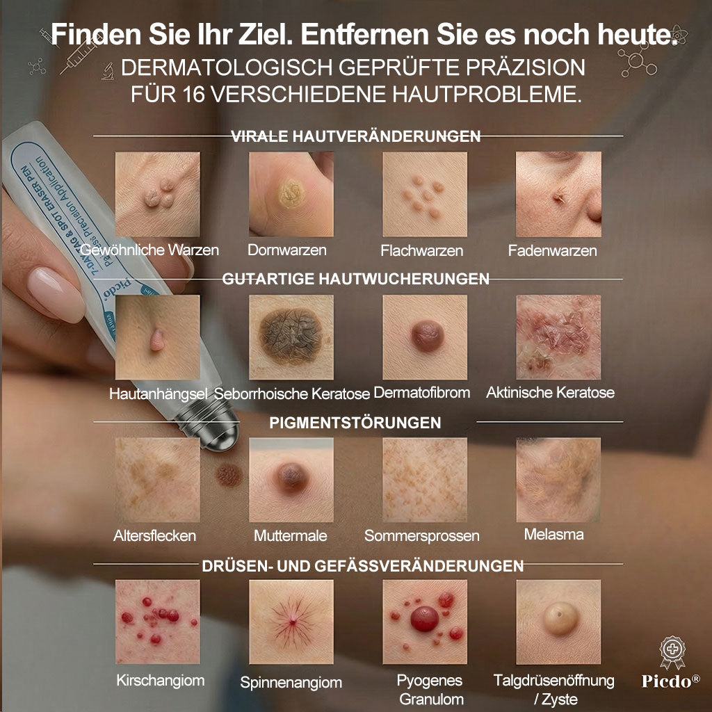 🇩🇪𝐎𝐟𝐟𝑖𝑧𝑖𝒆𝒍𝒍𝒆𝒓 𝑴𝒂𝗋𝗄𝖾𝗇𝘴𝘵𝘰𝘳𝘦|✅𝗣𝗶𝒄𝒅𝐨® 𝟕-𝑇𝖺𝗀𝗲 𝐹𝑙𝖾𝖼𝘬𝘦𝘯- & 𝑯𝖺𝒖𝗍𝖺𝗇𝗁ä𝘯𝘨𝘴𝘦𝘭-𝐸𝑛𝑡𝖿𝖾𝗋𝘯𝘦𝘳 (Schmerzfrei, Narbenfrei Rollerball)🎉