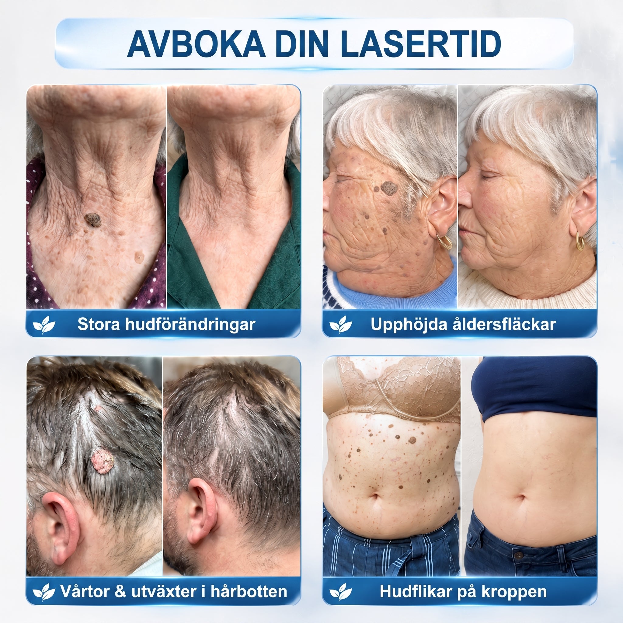 👩‍⚕️Officiell butik | 𝑵𝐞𝒌𝐢𝐬𝐬® 🌿 𝑴𝒊𝒌𝒓𝒐𝒏å𝒍 𝑭𝒆𝒍𝒇𝒓𝒊 𝑯𝒖𝒅 𝑩𝒐𝒓𝒕𝒕𝒂𝒈𝒏𝒊𝒏𝒈 𝑨𝒗 𝑽å𝒓𝒕𝒐𝒓 𝑷𝒍å𝒔𝒕𝒆𝒓 (𝐹ö𝑟 ℎ𝑢𝑑𝑓𝑙𝑖𝑘𝑎𝑟, 𝑠𝑚å ℎ𝑢𝑑𝑢𝑡𝑣ä𝑥𝑡𝑒𝑟, 𝑣å𝑟𝑡𝑜𝑟, 𝑓ö𝑑𝑒𝑙𝑠𝑒𝑚ä𝑟𝑘𝑒𝑛, å𝑙𝑑𝑒𝑟𝑠𝑓𝑙ä𝑐𝑘𝑎𝑟 𝑜𝑐ℎ 𝑝𝑖𝑔𝑚𝑒𝑛𝑡𝑒𝑟𝑖𝑛𝑔𝑠𝑝𝑟𝑜𝑏𝑙𝑒𝑚)