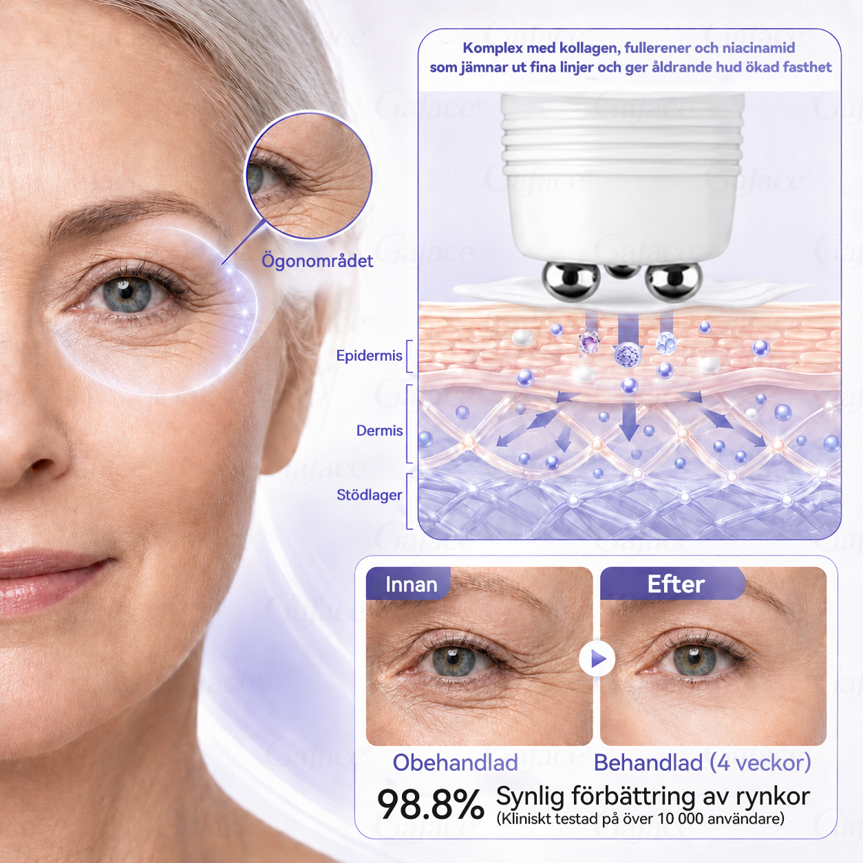 🎯🌸 𝐆𝐚𝐟𝐚𝐜𝐞® 𝐊𝐨𝐥𝐥𝐚𝐠𝐞𝐧- 𝐨𝐜𝐡 𝐅𝐮𝐥𝐥𝐞𝐫𝐞𝐧 𝐔𝐩𝐩𝐬𝐭𝐫𝐚𝐦𝐚𝐧𝐝𝐞 𝐑𝐨𝐥𝐥-𝐨𝐧-𝐤𝐫ä𝐦