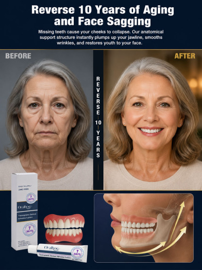 😁【Dentist Recommended】Premium Dental Prosthesis – All-Inclusive, No Dentist Needed!
