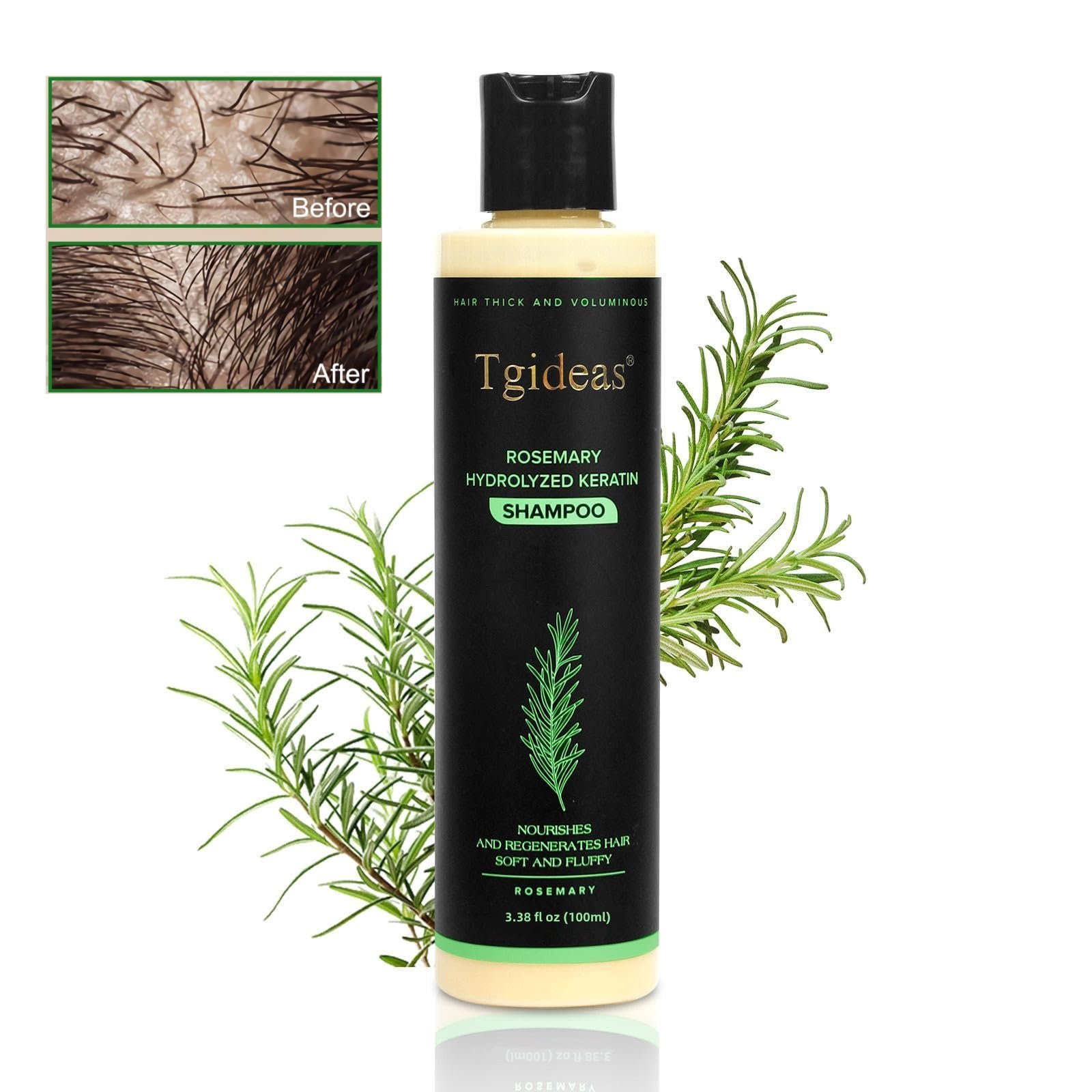 🔥Tgideas Organic Rosemary Hair Growth Shampoo🔥