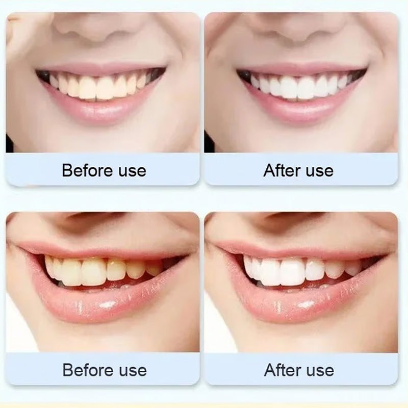 🦷 Probiotic-6 Advanced Oral Care Toothpaste