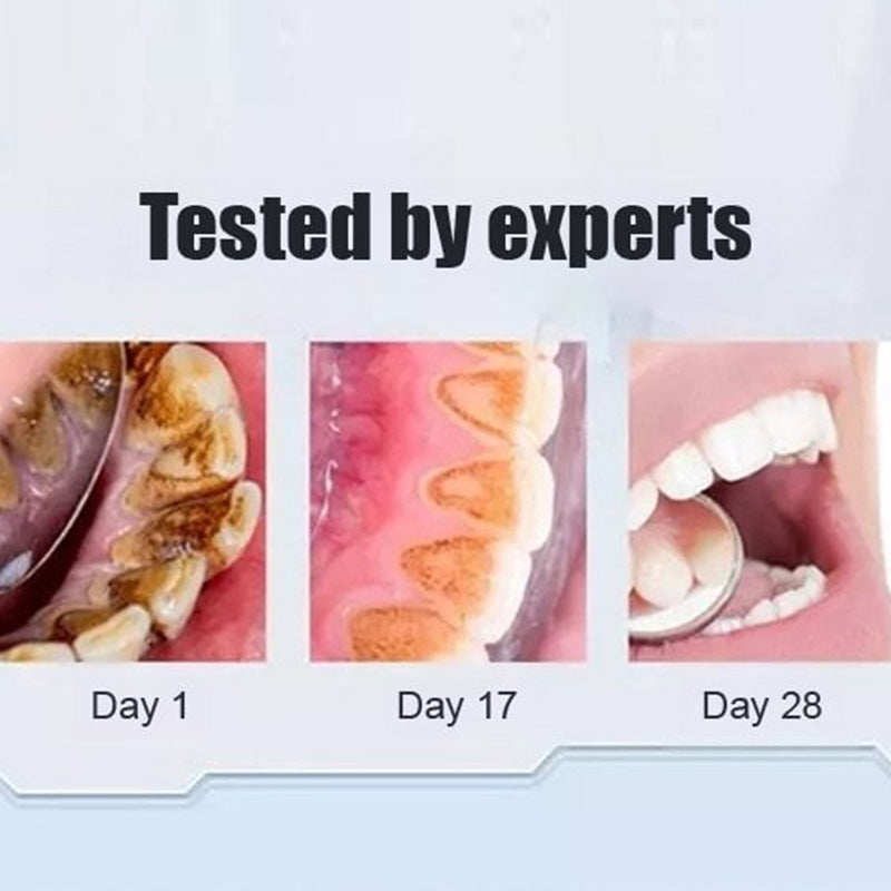 🦷 Probiotic-6 Advanced Oral Care Toothpaste