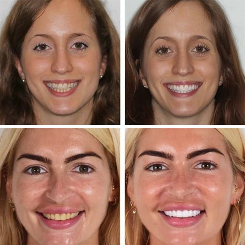 🦷 Probiotic-6 Advanced Oral Care Toothpaste